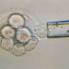 Embryons chimériques, PMA… La Loi Bioéthique en question! (10:34)