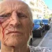 Médecin niçois âgé de 80 ans, agressé par un patient lors d’une visite à domicile